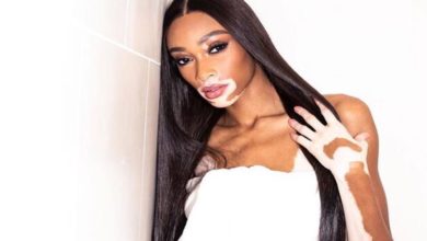 Winnie Harlow is eyeing up her own make up line