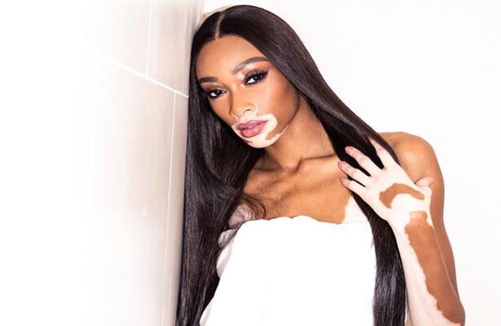 Winnie Harlow is eyeing up her own make up line
